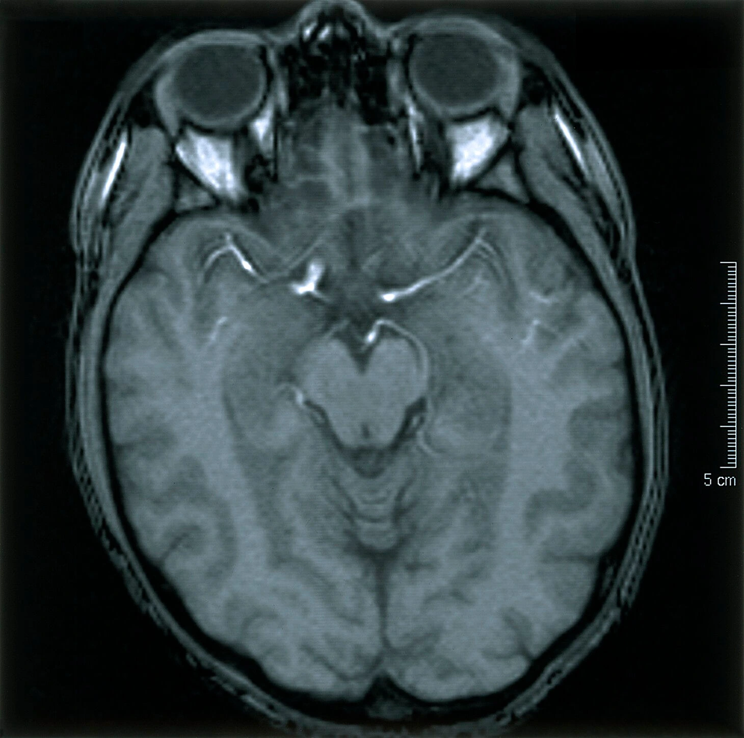A Wellcome Collection brain MRI illustrating one source record, rather than a personal life model